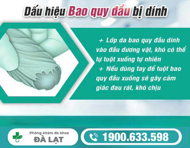 Hình ảnh minh họa